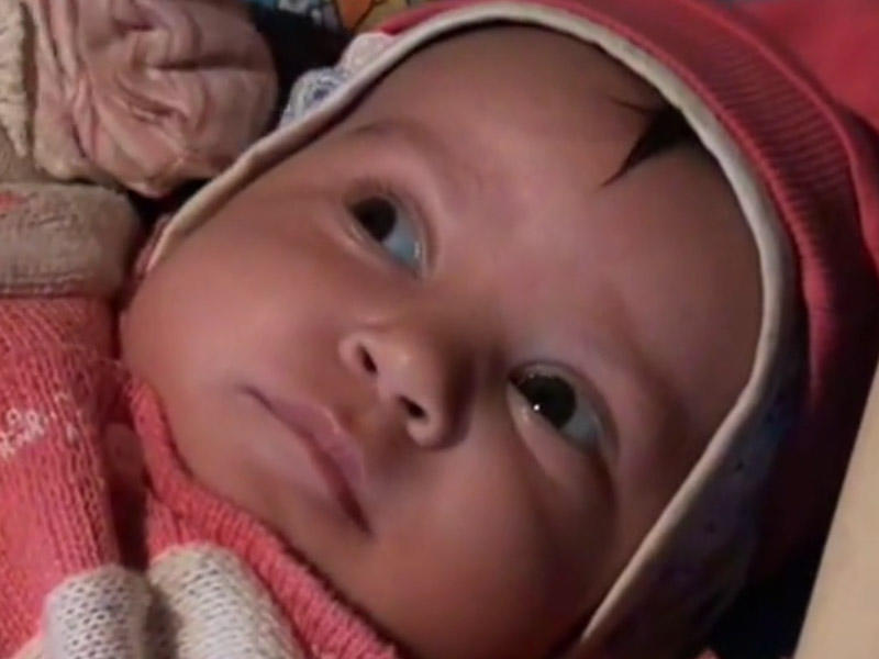 Azərbaycanda həkim səhlənkarlığı - 2 aylıq körpə kor oldu + Video