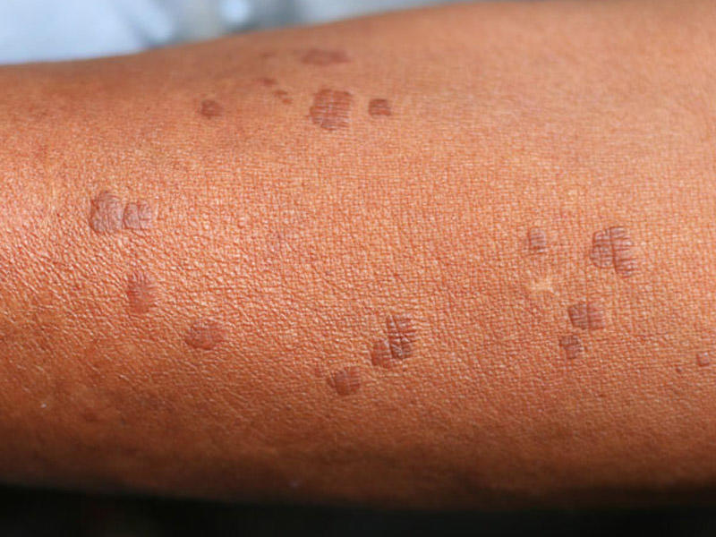 DİQQƏT! Sağ qolunuzda 11 xal varsa... - FOTOLAR