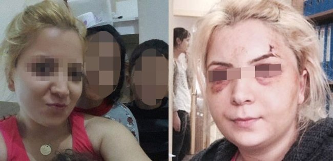 Dövlət televiziyasında BİABIRÇILIQ: 