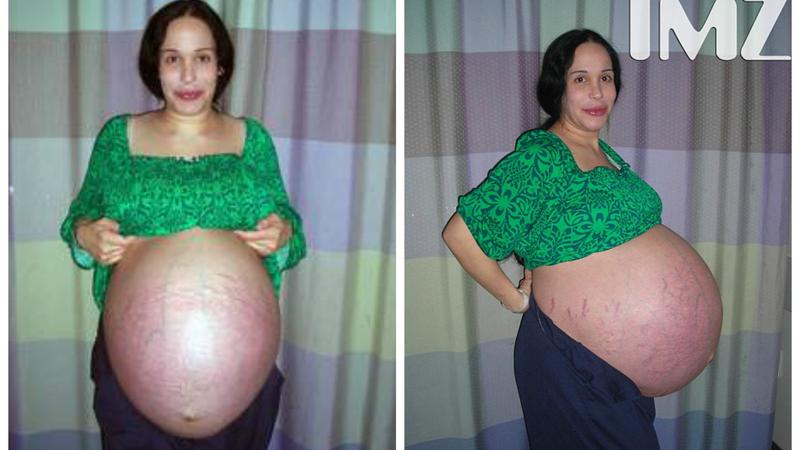 Bu qadının indiki halı görənləri şoka salır - FOTOLAR