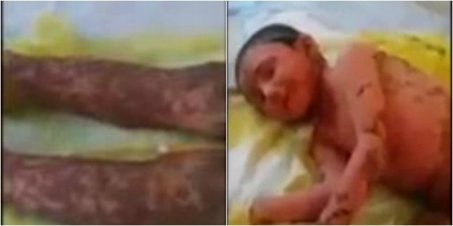 SƏHİYYƏDƏ NÖVBƏTİ BİABIRÇILIQ: YALANDAN PEDİATRAM DEYİB UŞAĞI BU HALA SALDI (+18 VİDEO)