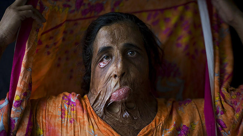 6 yaşında ərə verilən, cinsi münasibətə “yox” dediyi üçün... - DƏHŞƏTLİ QANUNLAR