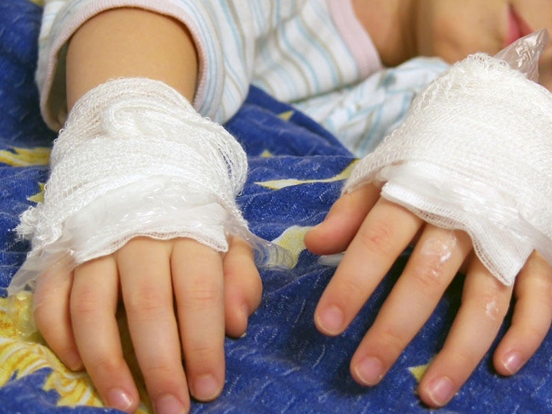 Türkiyədə PARTLAYIŞ: 1 uşaq yaralandı