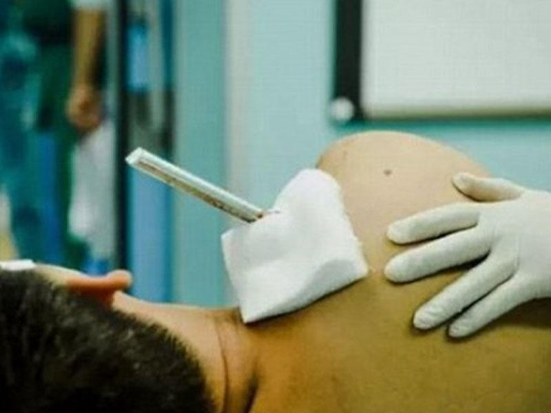 Armatur fəhlənin çiynindən girib belindən çıxsa da, sağ qaldı