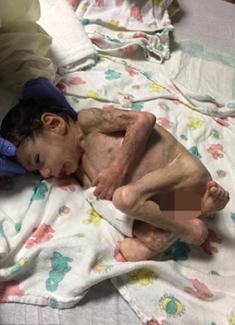 7 yaşlı 3 kiloluq uşağı belə xilas etdilər - DÜNYA BU OLAYDAN DANIŞIR+FOTOLAR