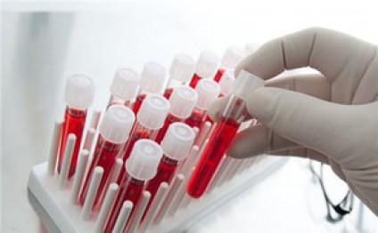 Azərbaycanda talassemiya xəstələrinin sayı açıqlanıb