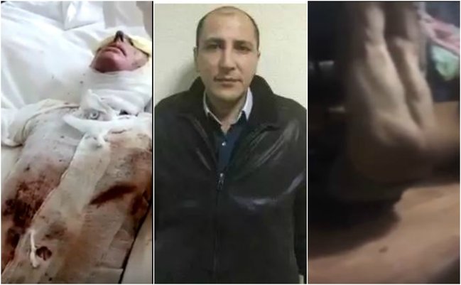 Azərbaycanlı gəlinin üstünə kislota tökdülər, dayısını soyundurub... VİDEO - FOTOLAR(+18 )