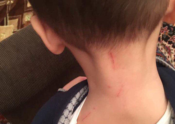 Bakıdakı uşaq bağçasında azyaşlıya qarşı VƏHŞİLİK - FOTO