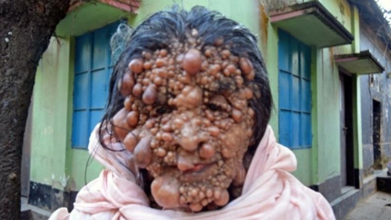 Həkim səhvi qadını BU HALA SALDI - FOTOLAR