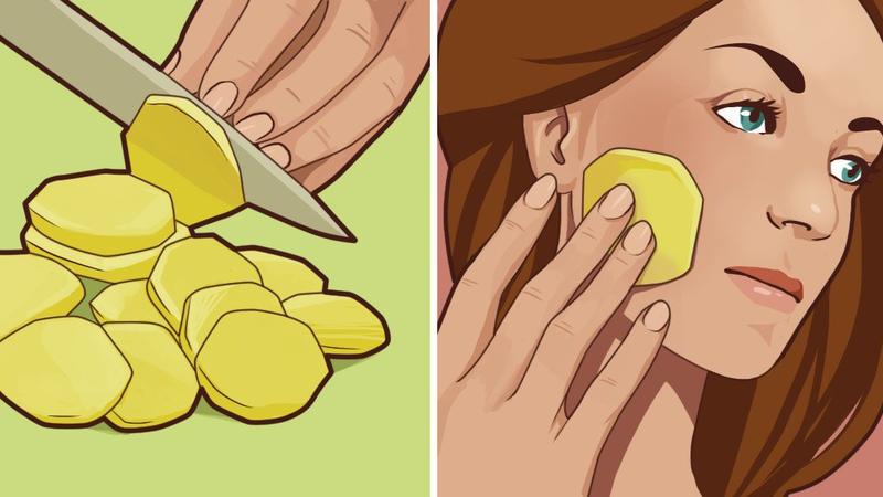 Çiy kartof dilimini hər gecə üzünüzə sürtsəniz...