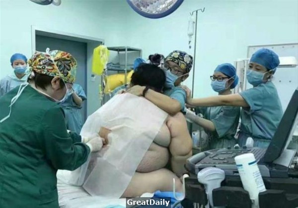 127 kq-lıq qadının doğuş zamanı çəkilən görüntüləri yayıldı - FOTOLAR