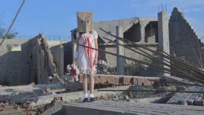 “Yaralı Hələb uşaqları