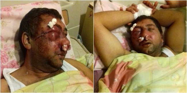 Bakıda DƏHŞƏT! Bacımı boşasan, başını kəsərəm dedi, kürəkənini belə günə qoydu (+18 FOTOLAR)