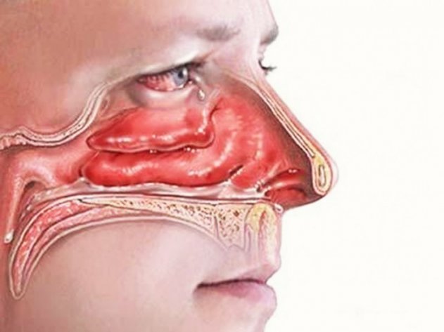 Sağlam ailə – Bu sadə metodun köməyi ilə 2 dəqiqədə burnunuz və nəfəs yollarınız açılacaq ! FOTO+VİDEO