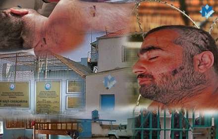 Dilini kəsən məhkumun atası: 