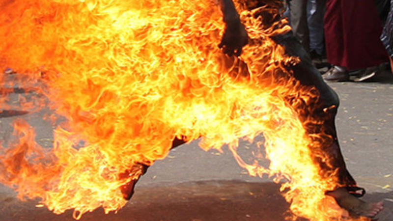 Bakıda özünü yandıran kişi xəstəxanada öldü