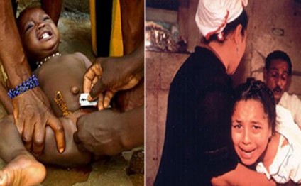 Qadın sünnəti haqqında bilmədiyiniz QORXUNC FAKTLAR