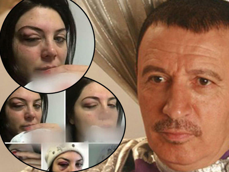 Müğənni həyat yoldaşını ÖLÜMLƏ HƏDƏLƏYİR: 