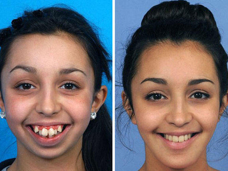 Bir vaxtlar üzündən utanan qız gözəllik kraliçası olacaq - FOTOLAR