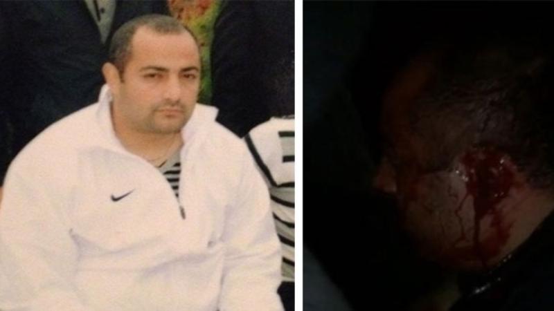 Lənkərasnkiyə qarşı döyüşən azərbaycanlı “oğru”nun elə yerini kəsdilər ki... - FOTOLAR (+18)