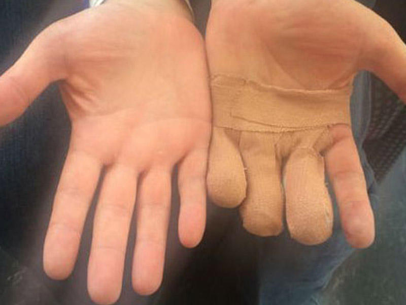 Polisdən DƏHŞƏTLİ İŞGƏNCƏ ! Lüt soyundurub, 3 barmağın qopardılar - FOTOLAR