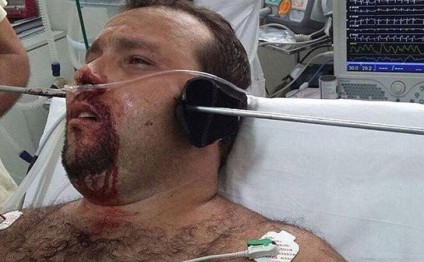 MÖCÜZƏ: Nizə başının bu tərəfindən girib o biri tərəfindən çıxdı, amma ölmədi - FOTO-VİDEO