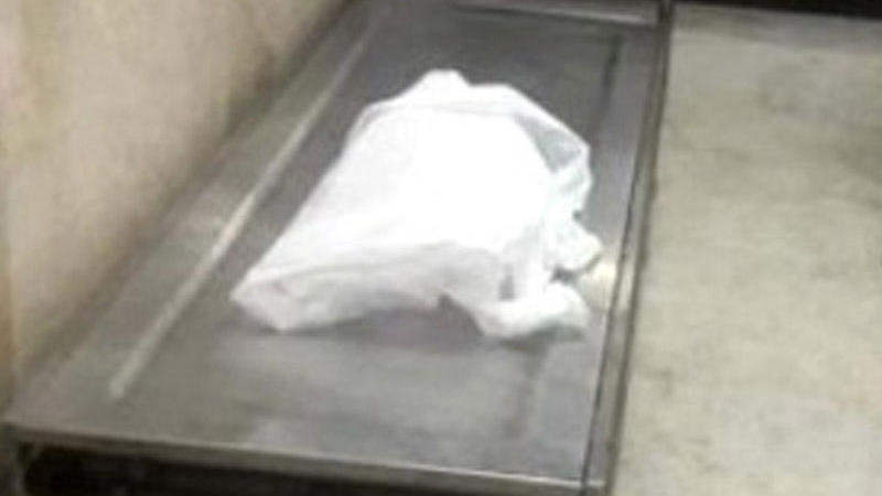 DƏHŞƏT: yeni doğulmuş uşağın qollarını kəsdilər - FOTO