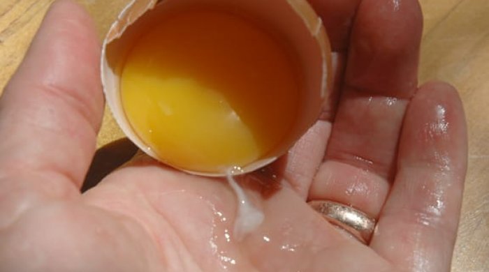 Yumurta sarısındakı ağ