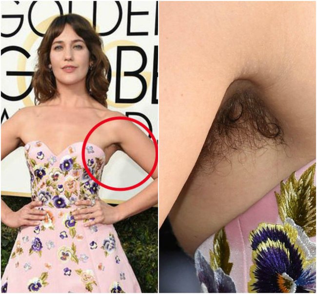 Məşhur aktrisa BİABIR OLDU: Qolunun altı ... - FOTOLAR