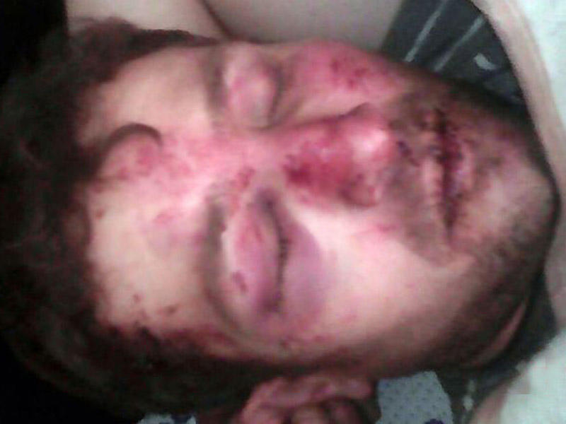 Goranboy sakinini huşunu itirənə qədər döydülər - FOTOLAR