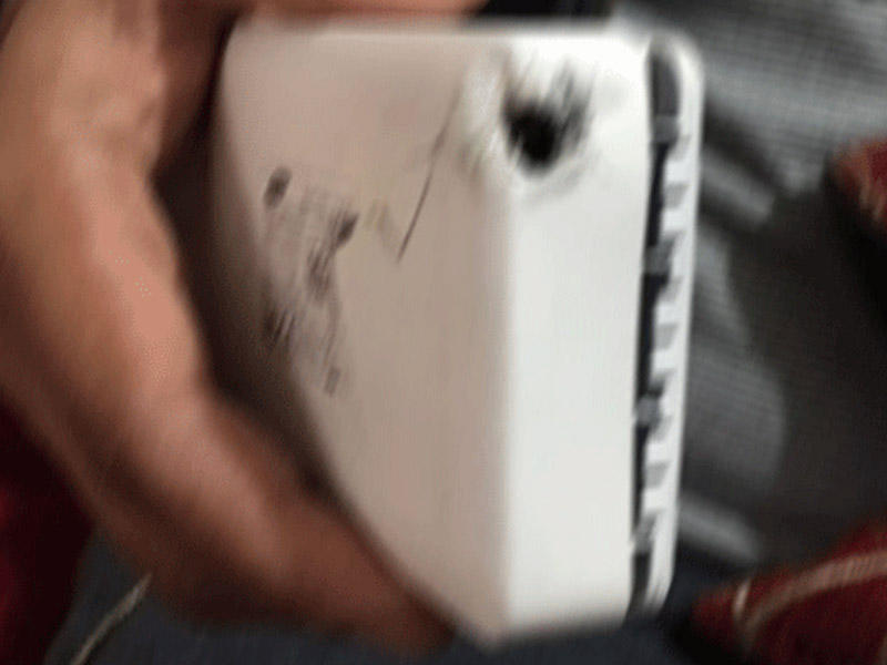 Çoxlarının istifadə etdiyi cihaz bir anda partladı, ağır yaralanan var