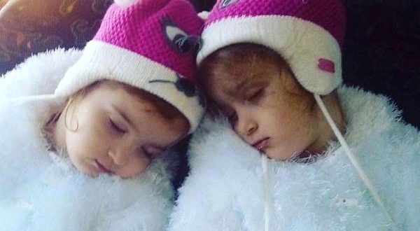 Ana əkiz qızlarını boğdu – Türkiyədə dəhşətli olay