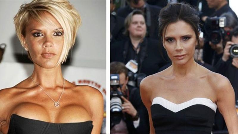 Viktoriya Bekhem sinəsini böyütdüyü üçün PEŞMAN OLDU və... - FOTOLAR