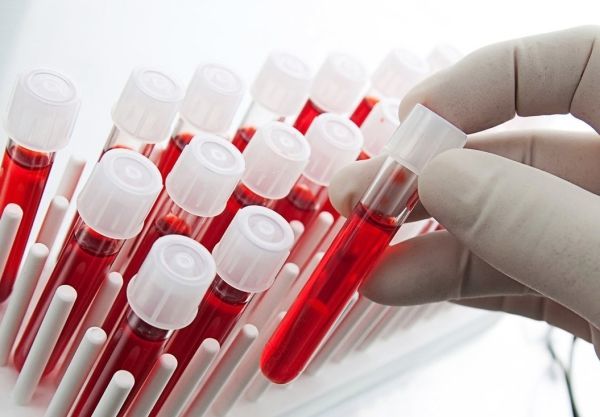 Azərbaycanda talassemiyadan ölənlərin sayı beş dəfə azalıb