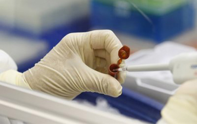 Azərbaycanda peyvənd neçəyədir?