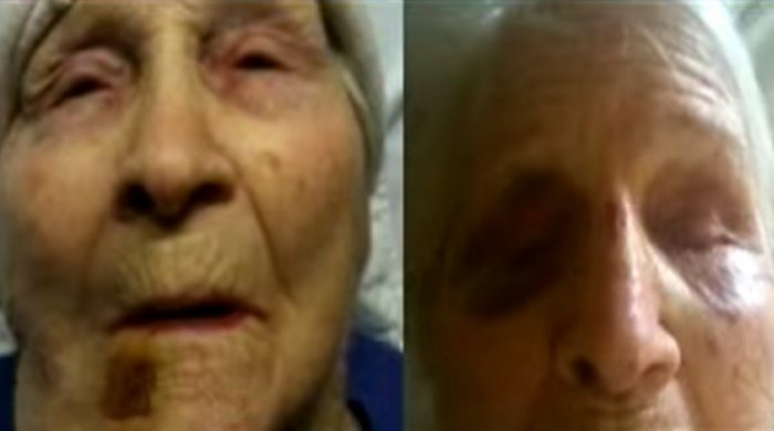 Tibb bacıları onları köməyə çağıran nənəni döyür, dil çıxararaq onu lağa qoyurlar- GİZLİ KAMERA