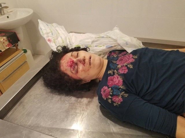 DİQQƏT ! Mərdəkanda qadını öldürdülər - cəsədi ortalıqda qalıb, TANIYAN ŞƏXSLƏR KÖMƏK EDİN (+18 FOTO)