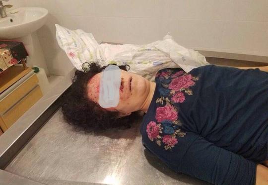 Özünü körpüdən atan qadın barədə - Təfərrüatlar