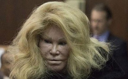 Estetik əməliyyatlarla tanınmaz hala düşmüşdü, indi də evini satır - FOTO