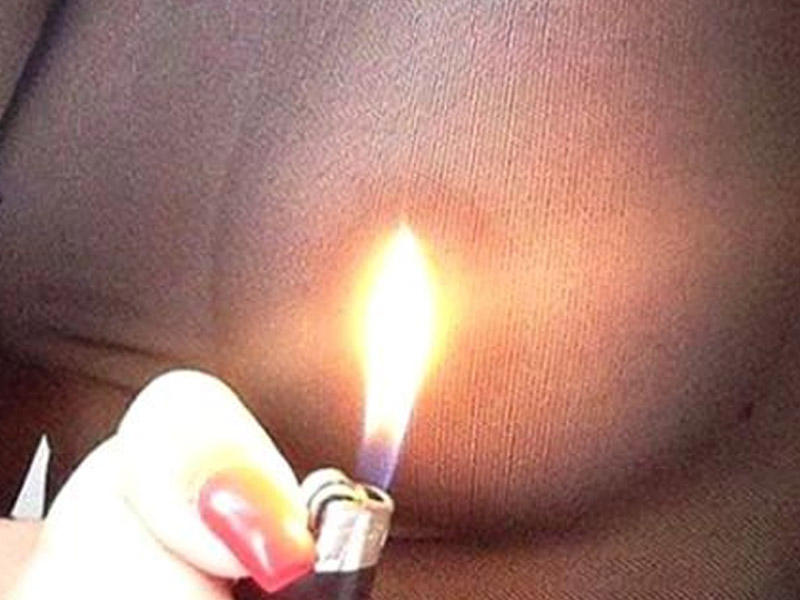 Cinsi bərabərsizliyə belə etiraz etdi -  Sinəsini yandırdı- FOTO