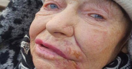 Bakıda məşhur şəxsiyyətin gəlininə qarşı vəhşilik - Foto