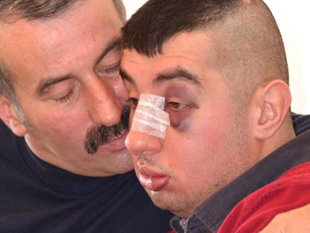 Küçədə qızla tanış olmaq istəyən oğlanı vəhşicəsinə döydülər – FOTO + VİDEO