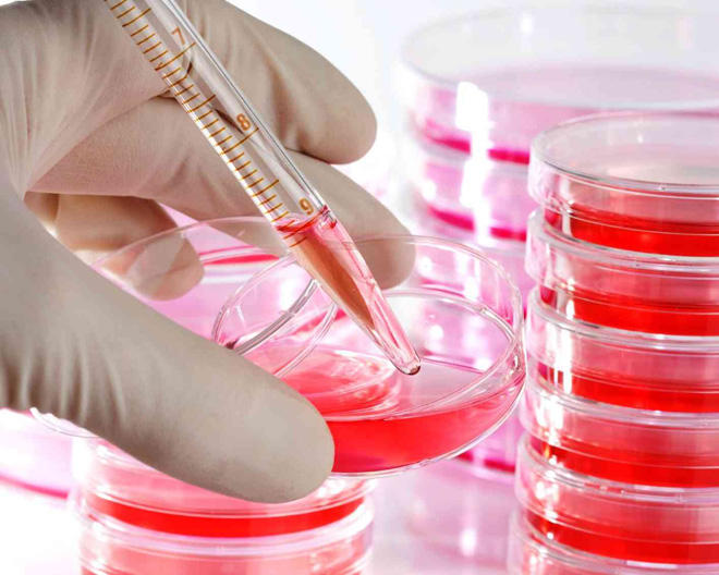 Azərbaycanda süni mayalanma istəyənlərin sayı artıb