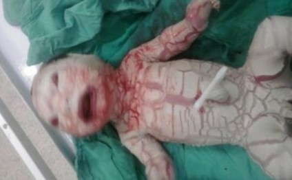 Türkiyədə hamilə qadın dünyaya ilan gətirdi - Əsəbi zəif olanlar izləməsin - VİDEO