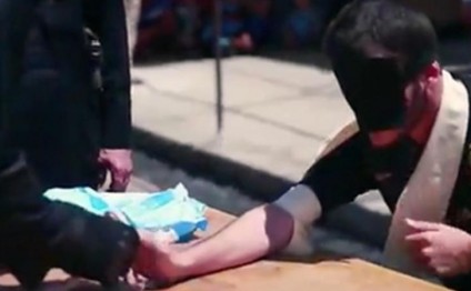 İŞİD uşaqların əllərini kəsdi - SƏBƏB