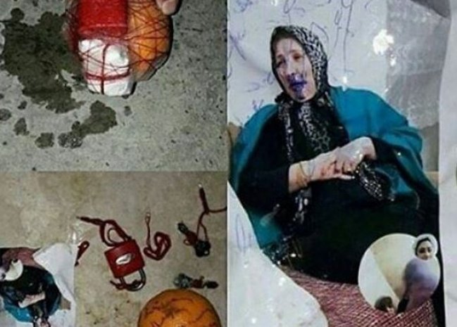 Bulvarda cadu tapıldı: Üstünə sancılmış iynə, qıfıl... - FOTO