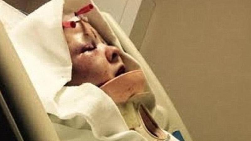 Sevgilisinə qarşı DƏHŞƏTLİ HƏRƏKƏT: baş dərisini qopardı, iti ilə...