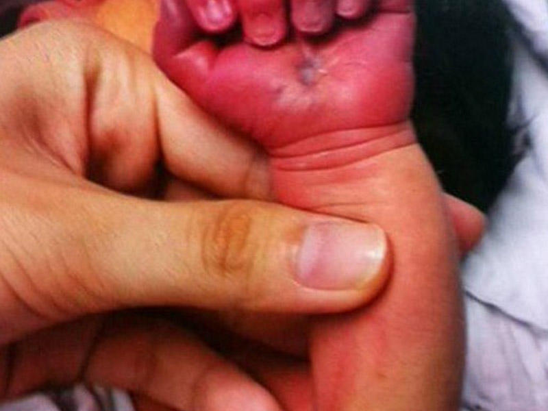 DƏHŞƏT ! Ana yenicə dünyaya gətirdiyi övladını gəmirməyə başladı