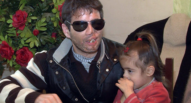 Azərbaycanlı gənc gözlərini sevgisinə qurban verdi: Övladlarımı həyatda görməsəm də, yuxuda görürəm