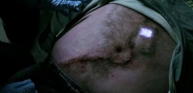 Gənc oğlan mobil telefon uddu – VİDEO